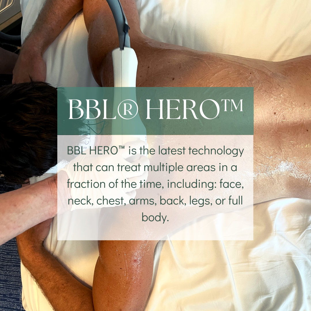 BBL Hero Treatment